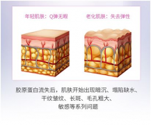 对抗衰老，让肌肤逃出时间黑洞